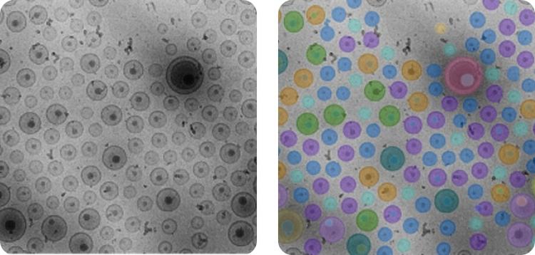 NanoSMART, an AI cryoEM system, automatically identifies nanoparticle features in images from various electron microscopes