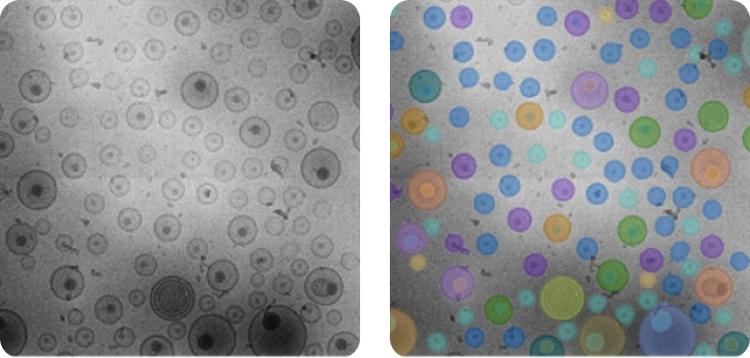 NanoSMART, an AI cryoEM system, automatically identifies nanoparticle features in images from various electron microscopes