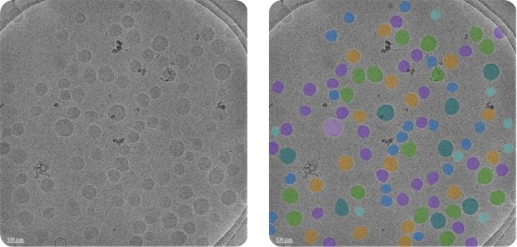 NanoSMART, an AI cryoEM system, automatically identifies nanoparticle features in images from various electron microscopes