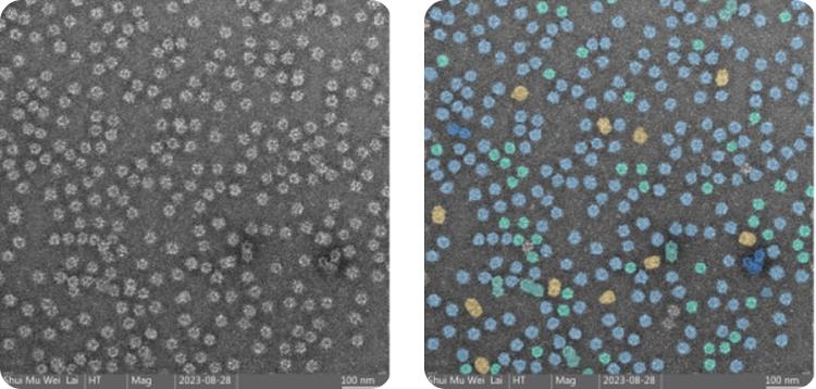 NanoSMART, an AI cryoEM system, automatically identifies nanoparticle features in images from various electron microscopes